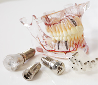 インプラント器具と歯の模型