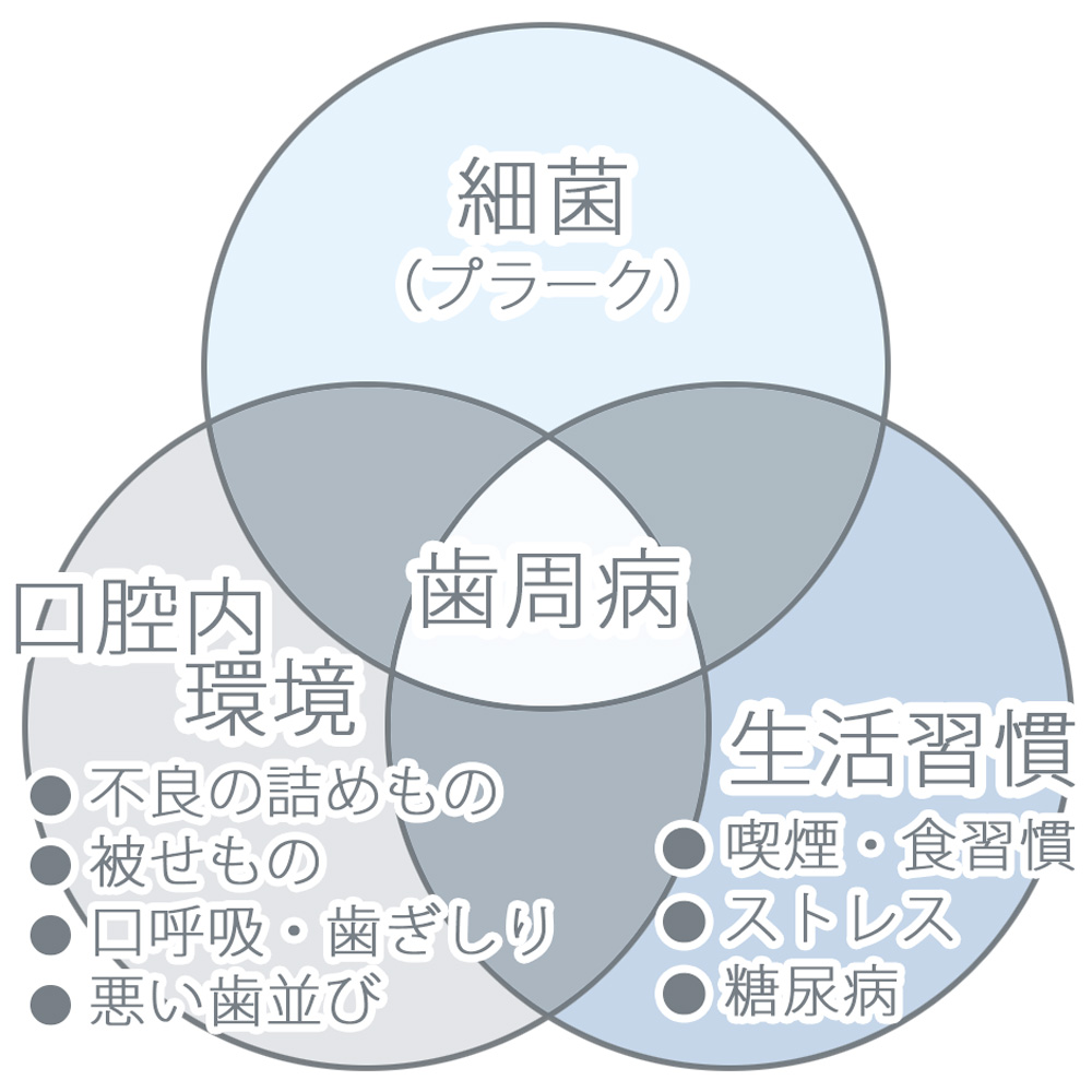 インプラント周囲炎の原因